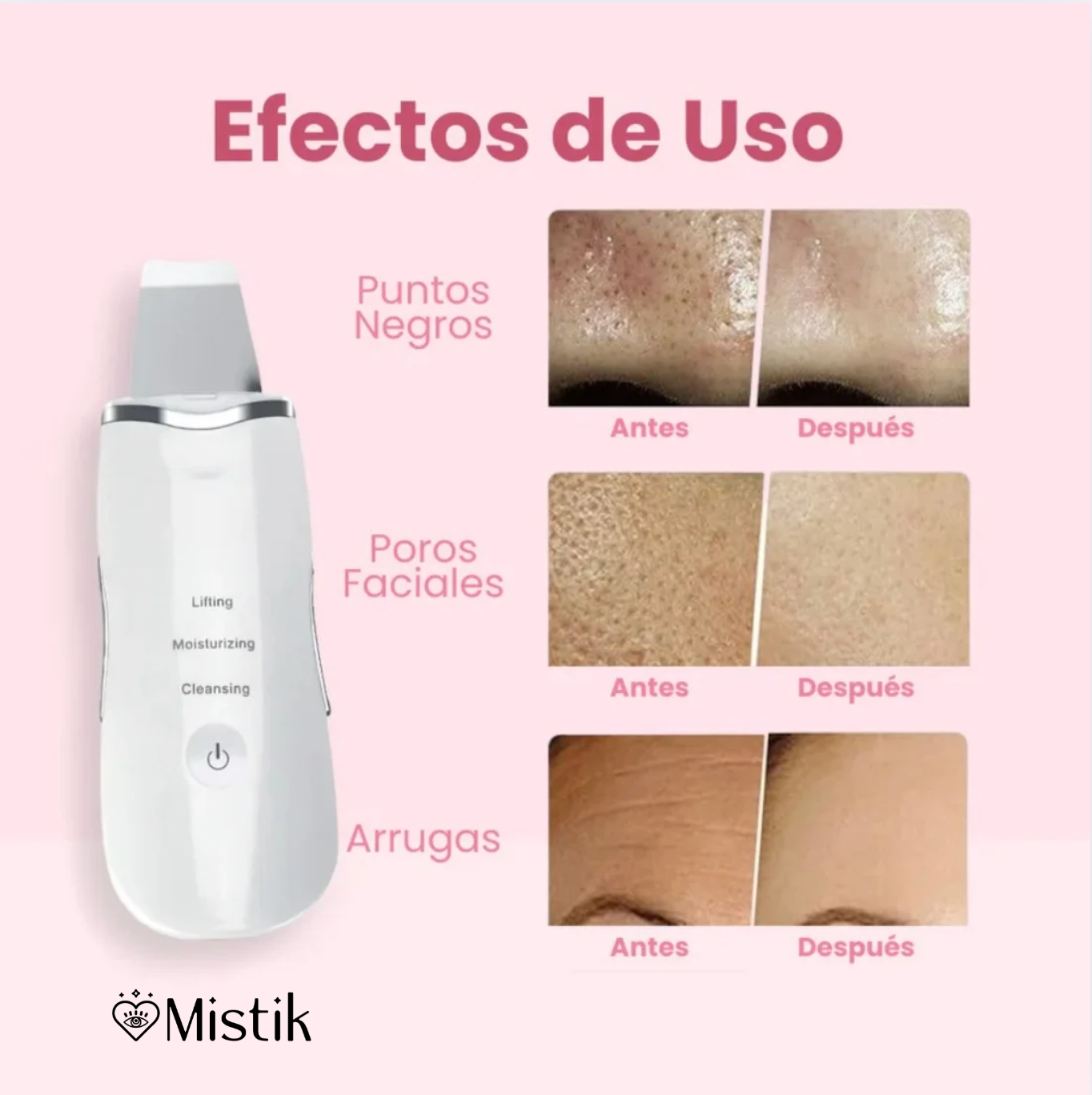 Limpiador Ultrasónico MultiPeel Power®